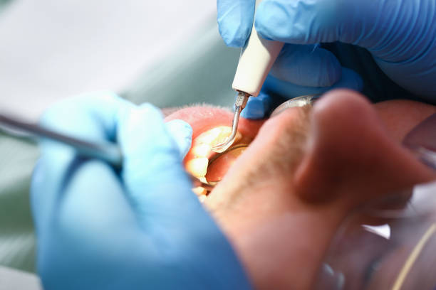 Best Broken or Cracked Tooth Emergency Dentist in Lawrencevle, IL
