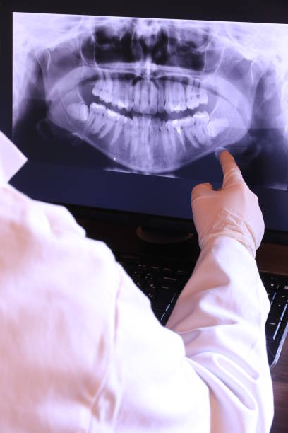 Best Mobile Emergency Dentist in Lawrencevle, IL