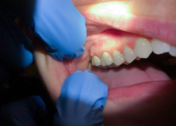 Best Holiday Emergency Dentist in Lawrencevle, IL