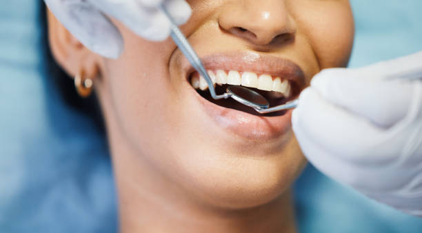Best Emergency Dentist for Knocked-Out Tooth in Lawrencevle, IL